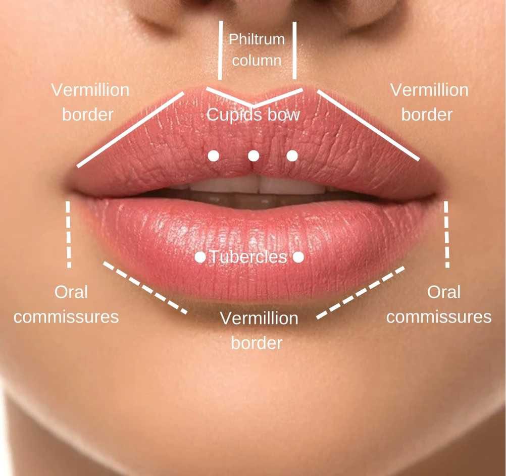 Lip Filler